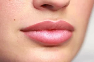 Aquarelle Lips Healing: What to Expect During Recovery
