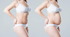 Tummy Tuck Surgery in Riyadh