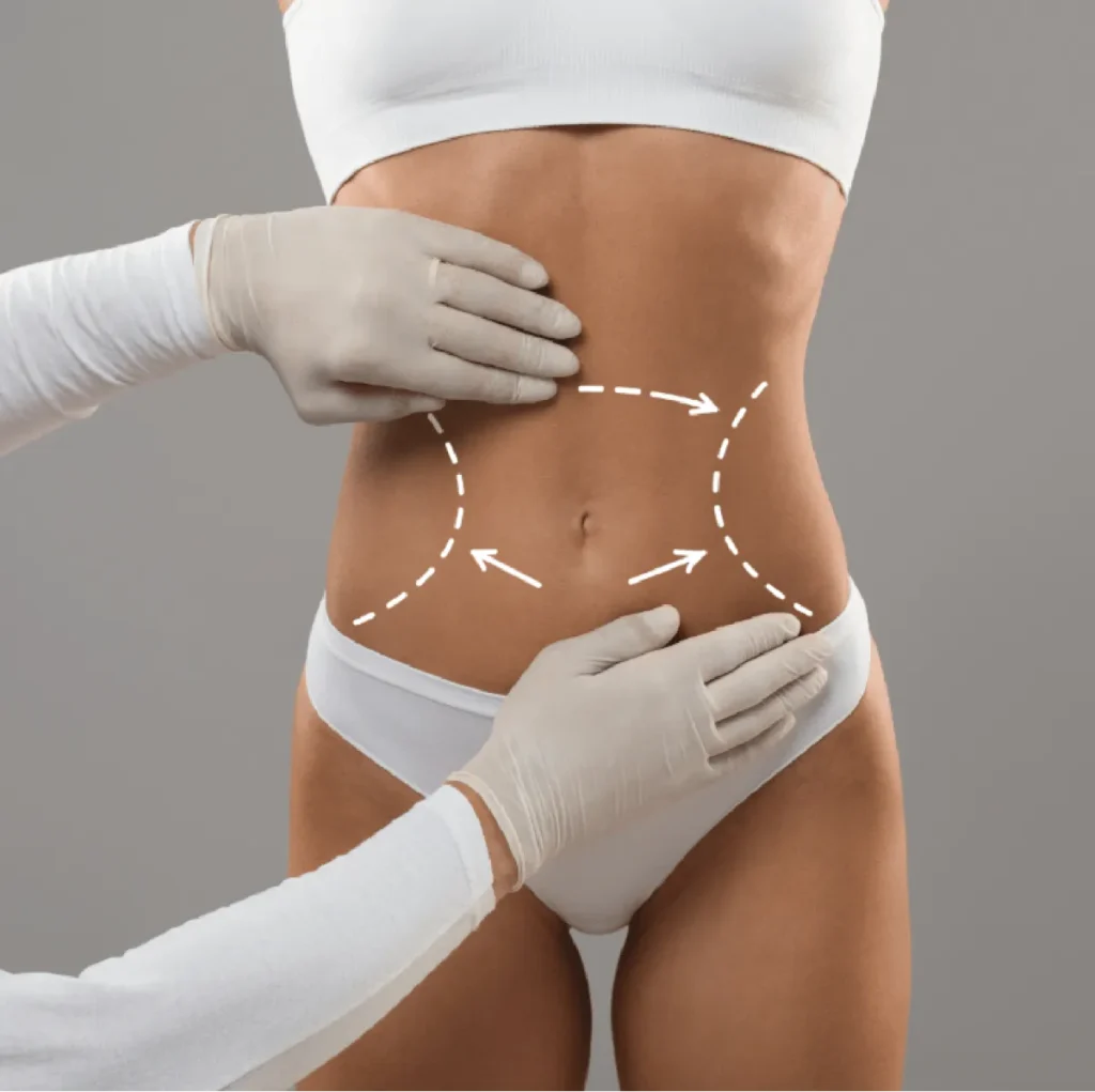 Building a Trusting Relationship with Your Best Liposuction Surgeons in Dubai