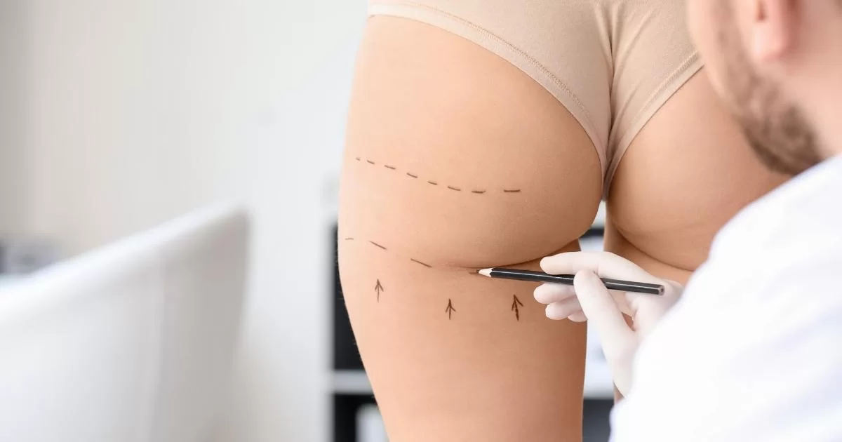 Innovative Techniques Offered at the Best Aesthetics Clinic in Dubai for Butt Fillers