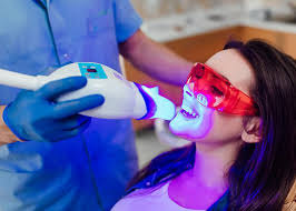 Teeth Whitening Treatment in Islamabad