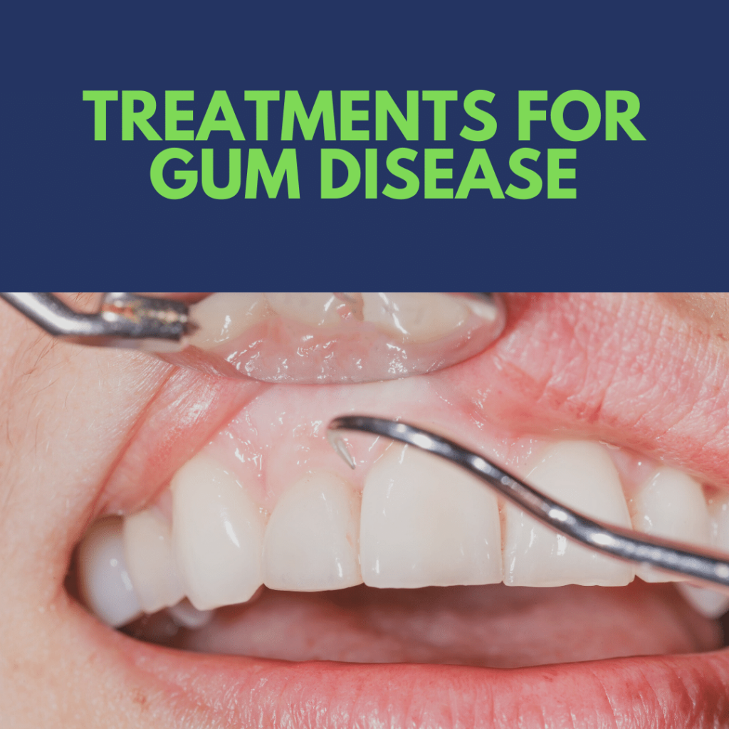 Gum Disease Treatment