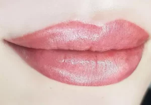 Aquarelle Lips Healing: What to Expect During Recovery