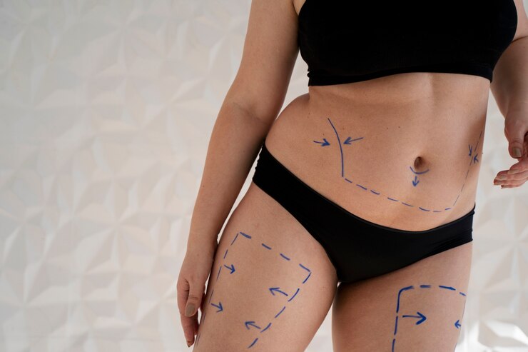 Body Contouring near me