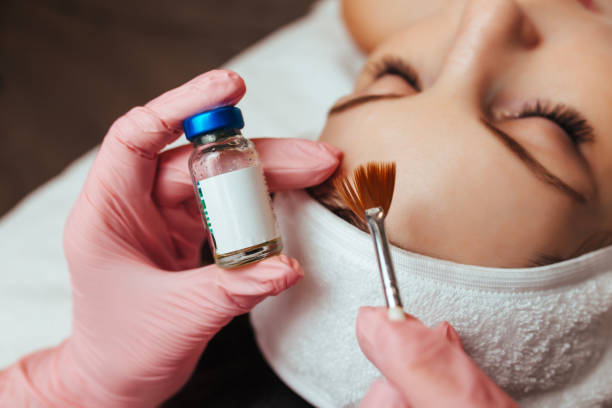 Deep Chemical Peel treatment