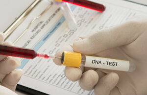 DNA Test in Riyadh