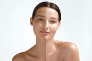 How Long Does It Take to See Results from Permanent Skin Whitening