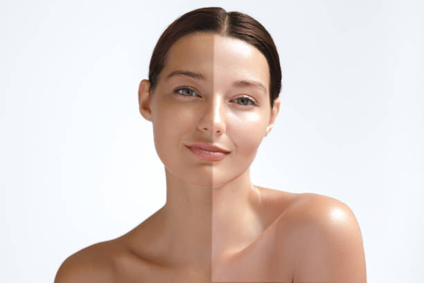 How Long Does It Take to See Results from Permanent Skin Whitening