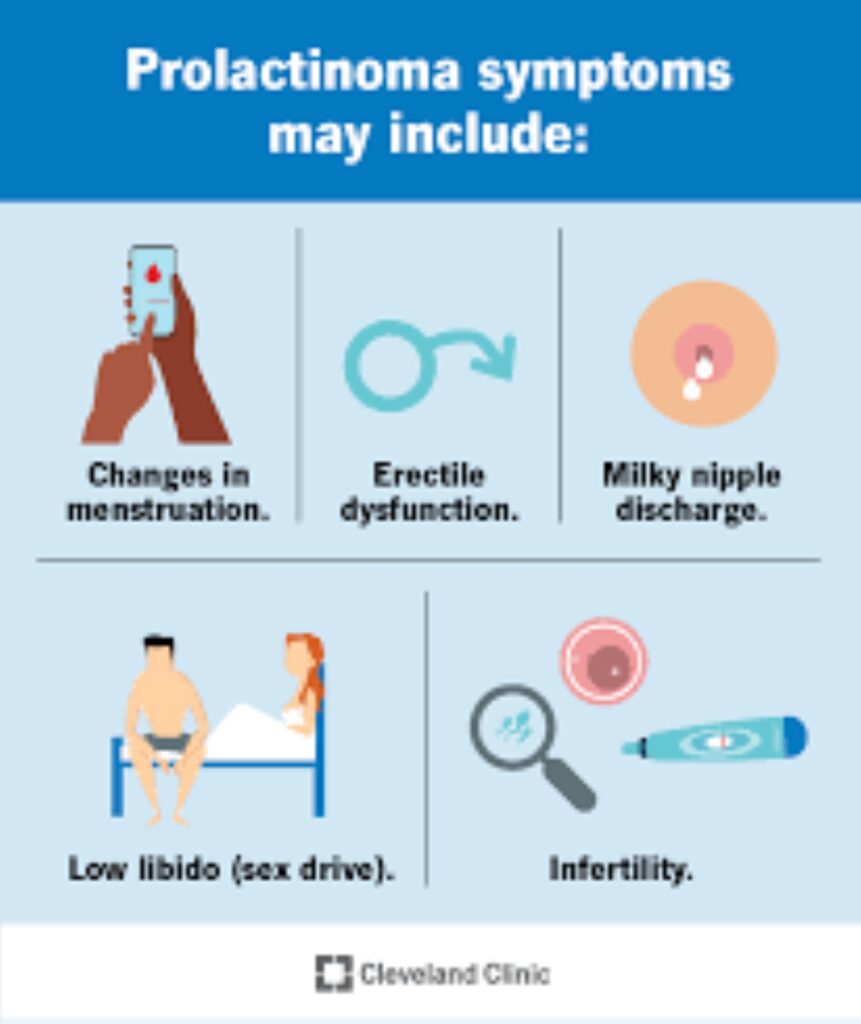 Prolactinoma symptoms