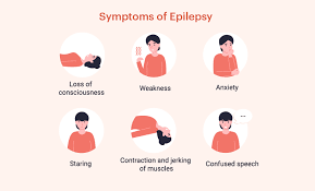 Epilepsy