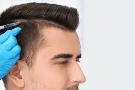 Hair Transplant in Dubai