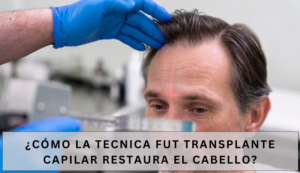 tecnica fut transplante capilar