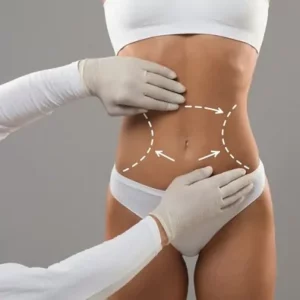 Best Clinics for Fat Transfer Surgery in Dubai: What to Look For