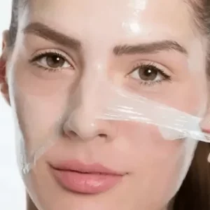 Chemical Peels in Islamabad