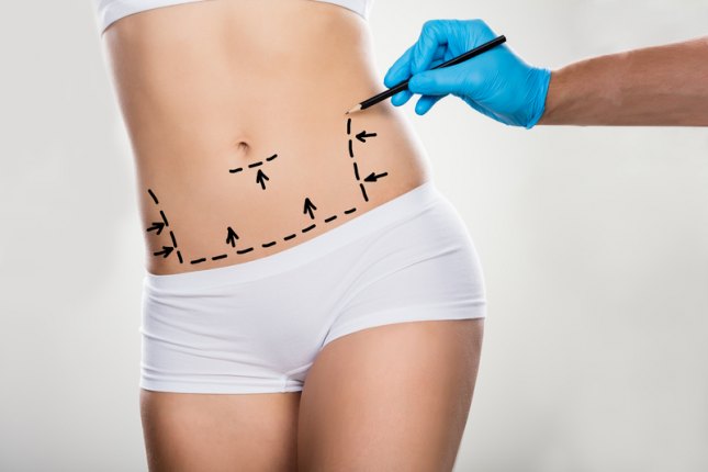 Liposuction Riyadh