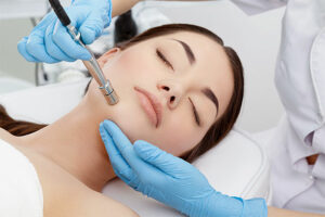 Microdermabrasion treatment in Islamabad