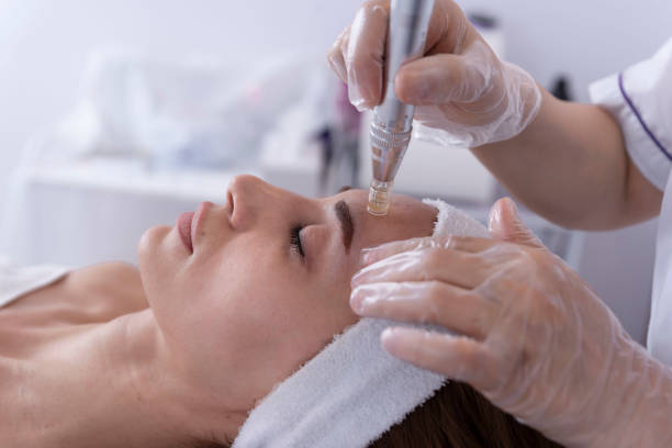 Microneedling in Islamabad