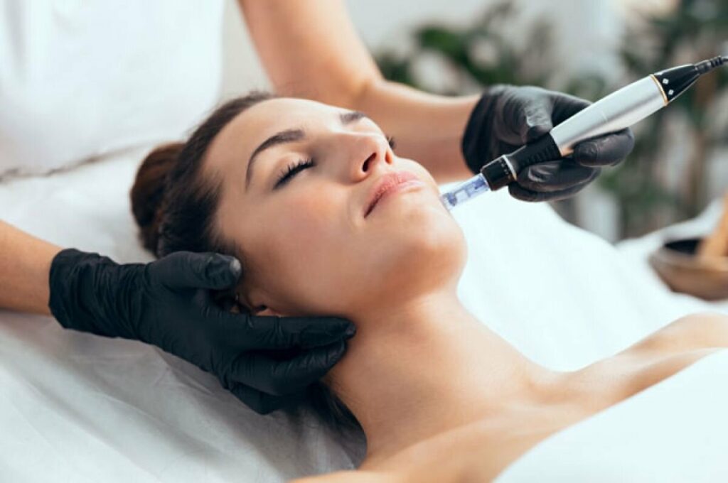 Microneedling NYC