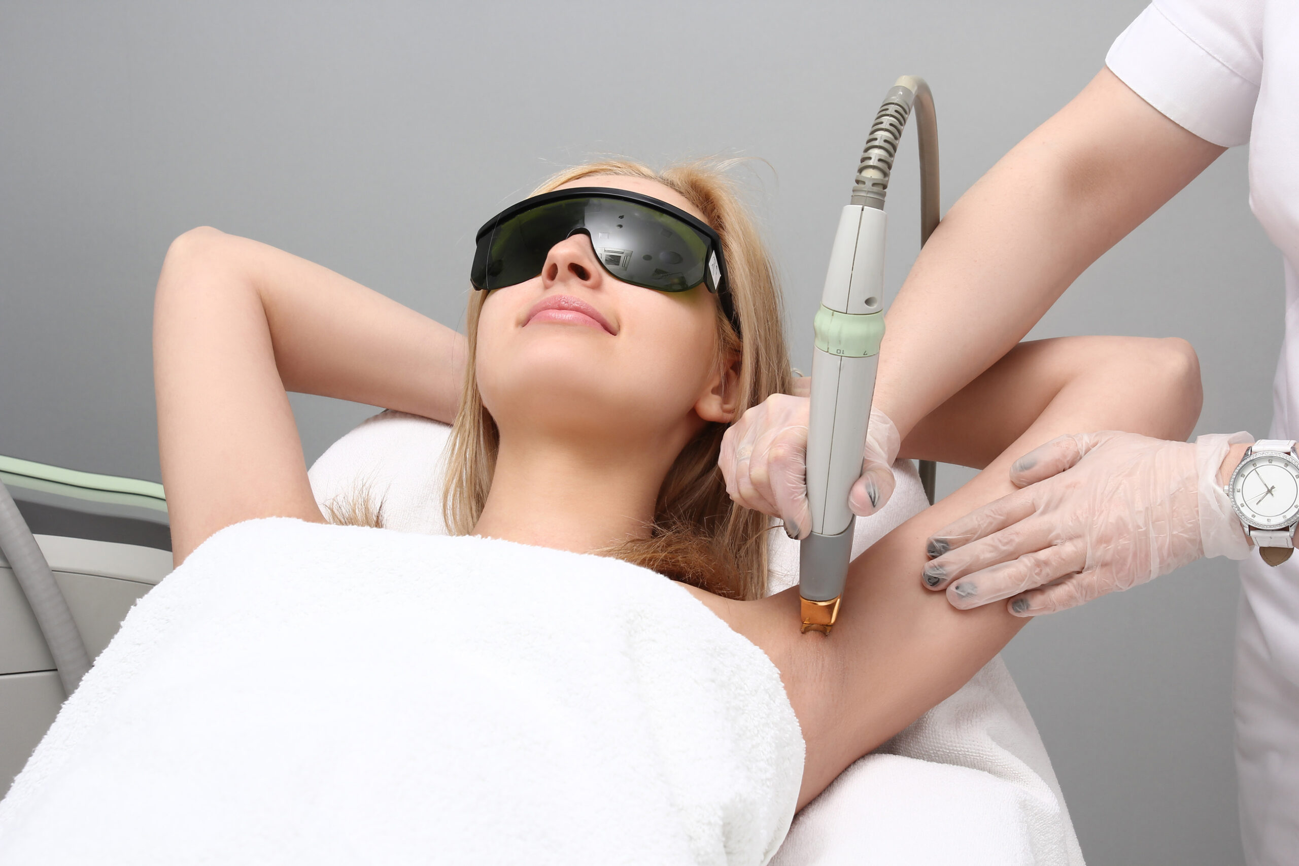 laser hair removal fort collins