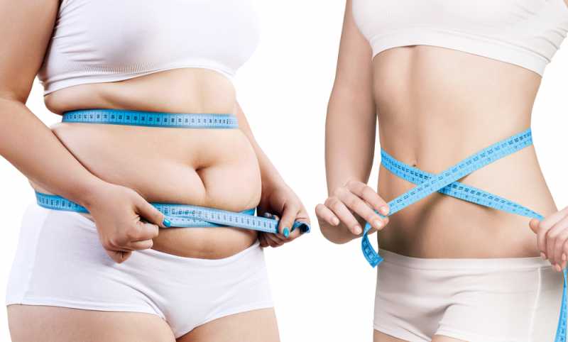 Weight Loss Treatment Hammersmith