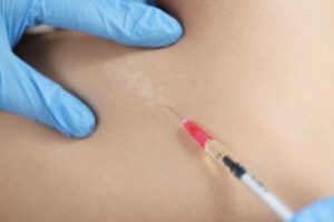 Fat melting injection in Dubai