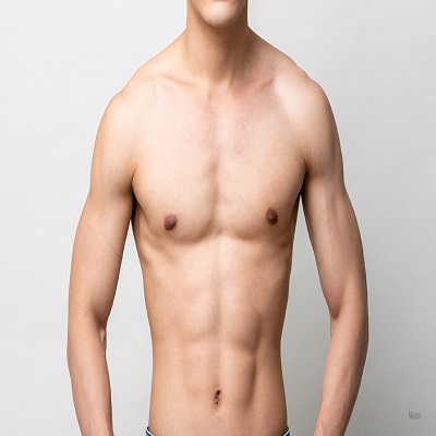 Gynecomastia In Islamabad