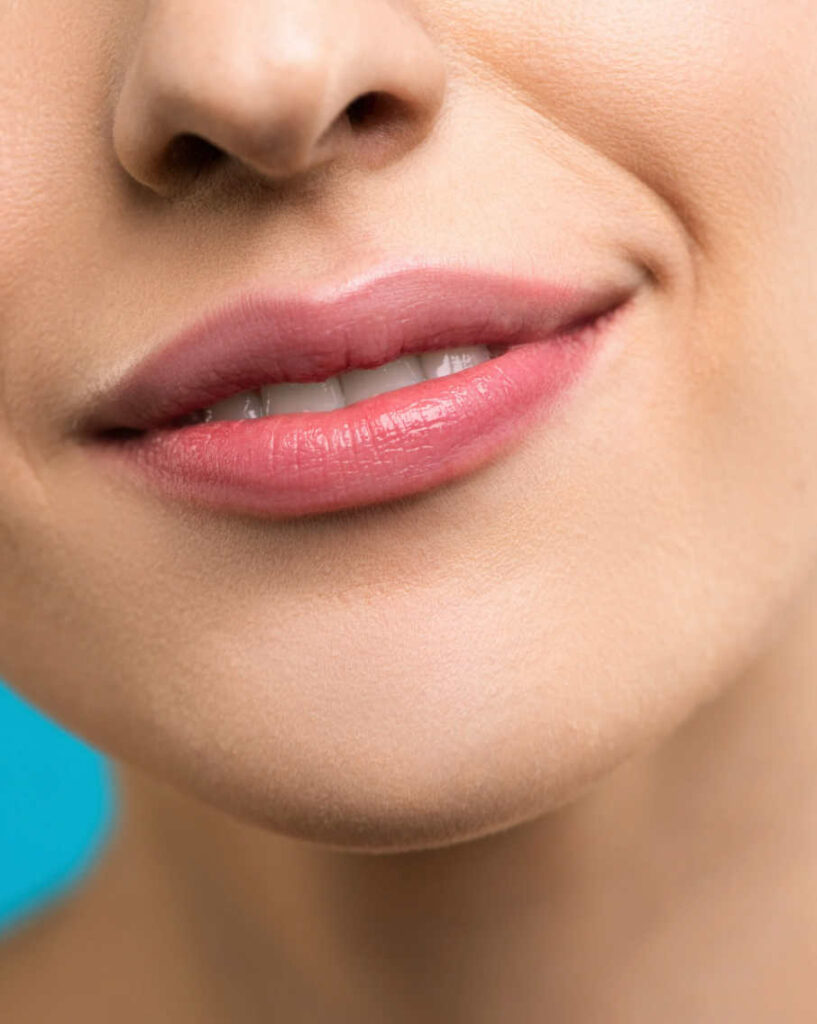 lip augmentation in Islamabad