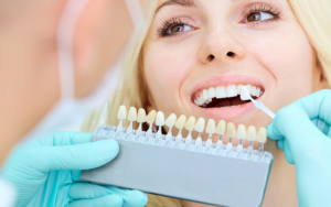Veneers Near Me - Art of Smiles Fontana