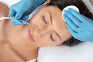 blackhead treatment dermatologist