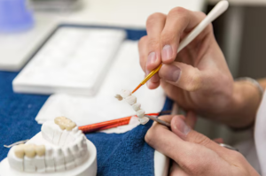 dental crowns georgetown ky