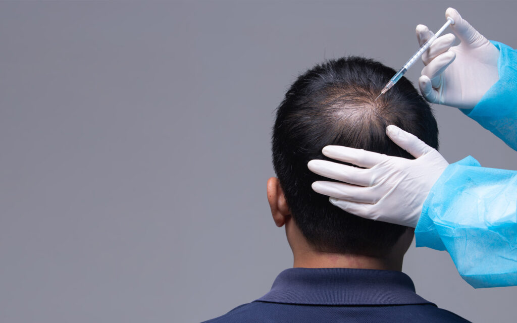Dermatologist treatment for hair loss