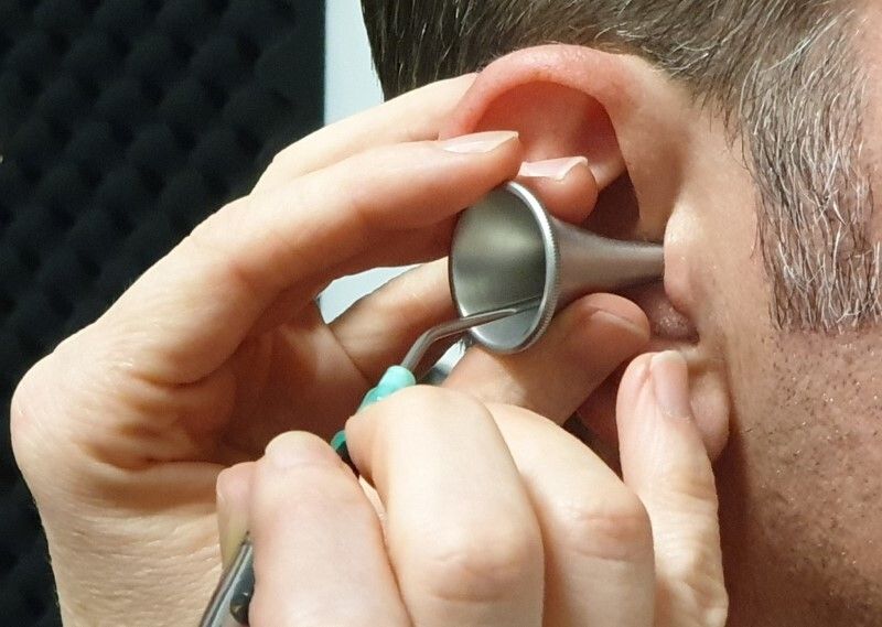 ear wax removal service near me