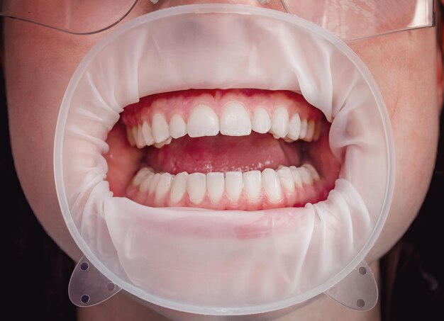 full mouth restoration robertsdale al