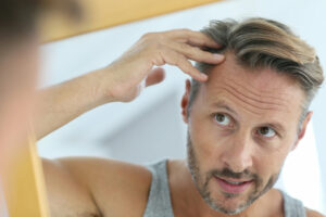 Can Hair Transplants Fix a Receding Hairline?