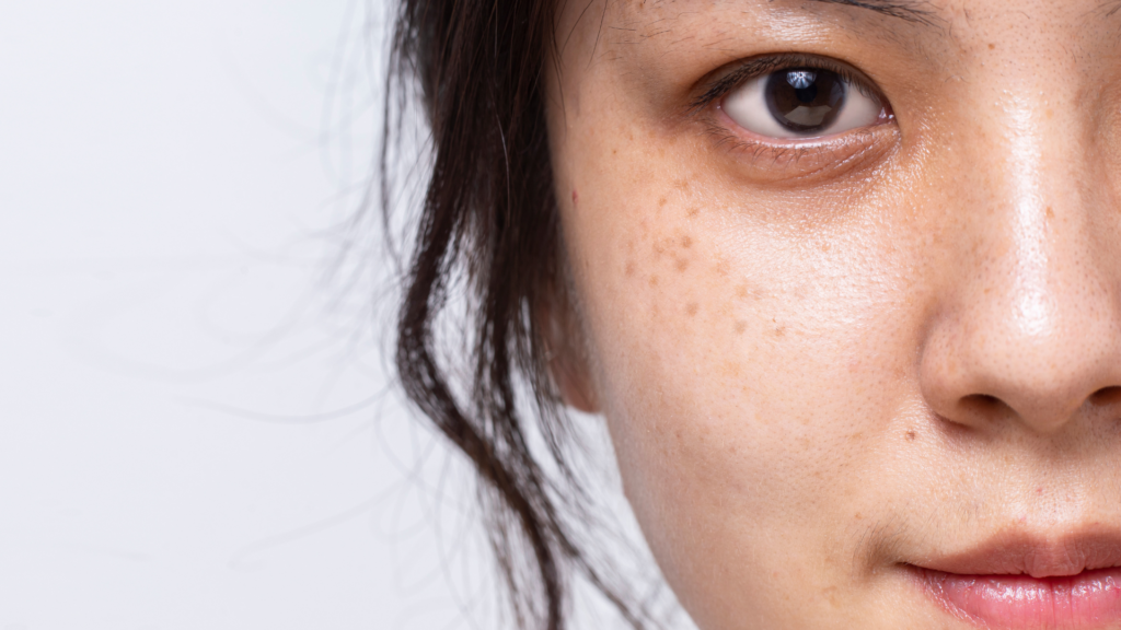 hyperpigmentation​ treatment products