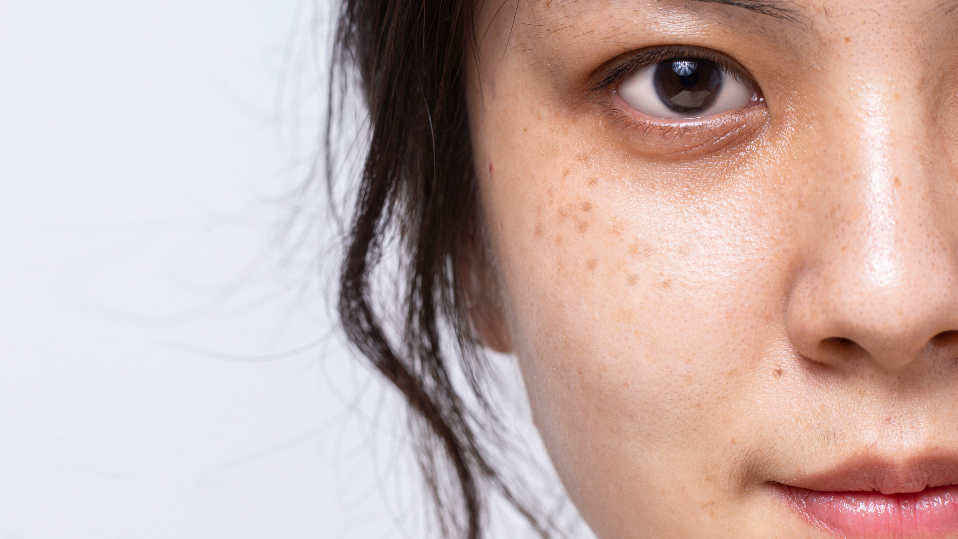hyperpigmentation​ treatment products