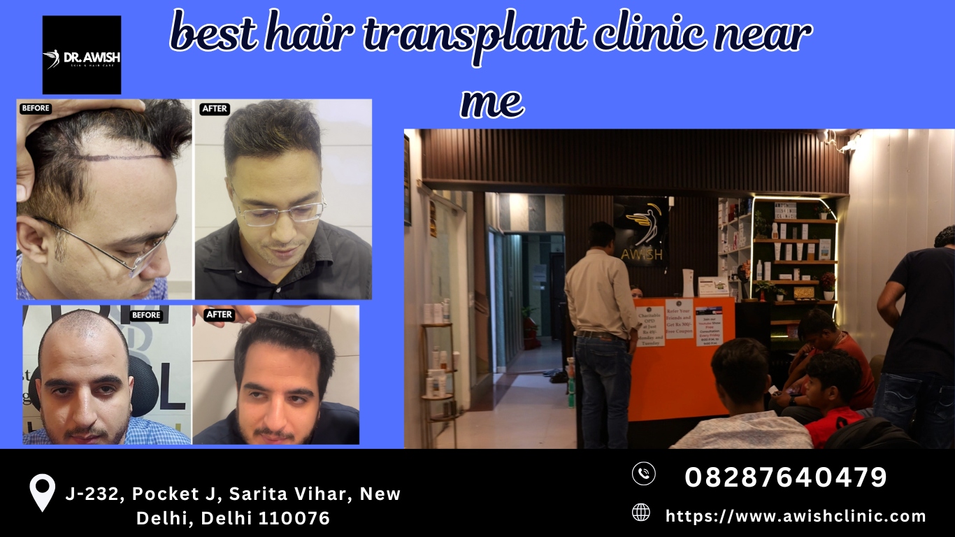 Top hair Clinic In Delhi