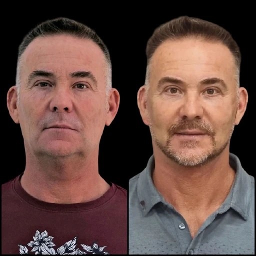 Best Plastic Surgeon in dubai