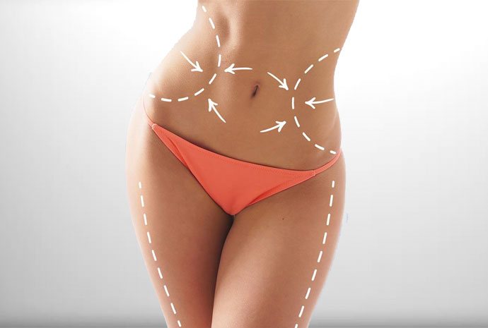 Laser Liposuction in Dubai the Best Solution for Stubborn Fat Removal
