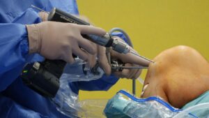 Knee Replacement Surgery: Procedure, Recovery & Cost