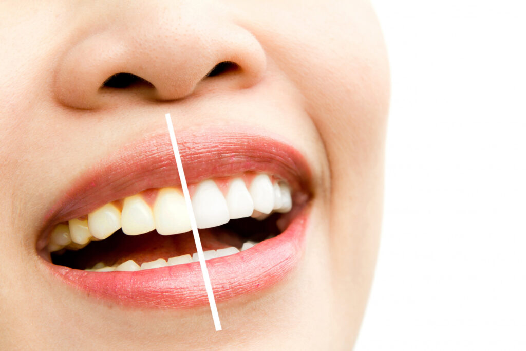 smile design clinic dwarka