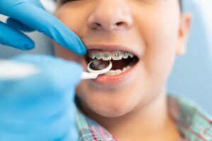 braces cost franklin tn