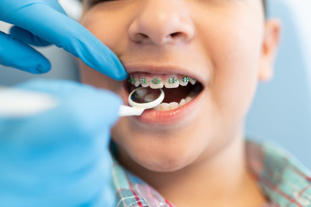 braces cost franklin tn