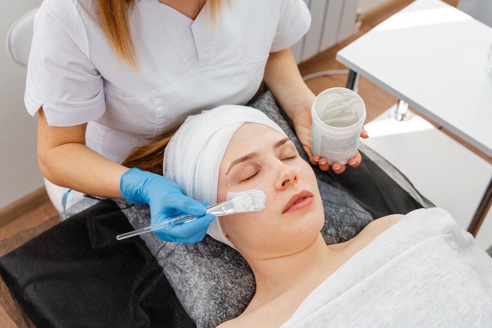 chemical peel treatment