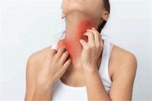 10 Unusual Allergy Symptoms