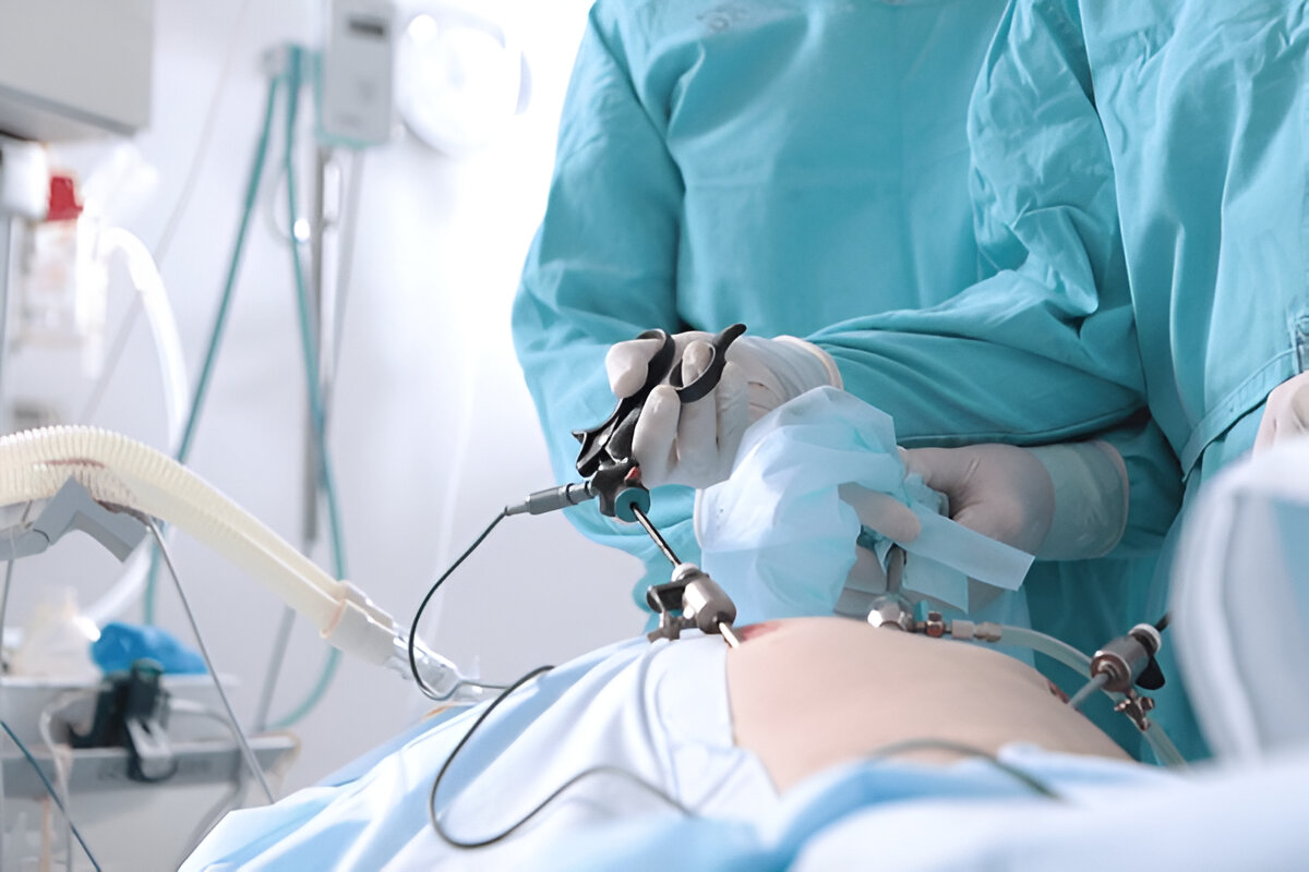 How long does Hernia Surgery take?