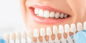Teeth Whitening
