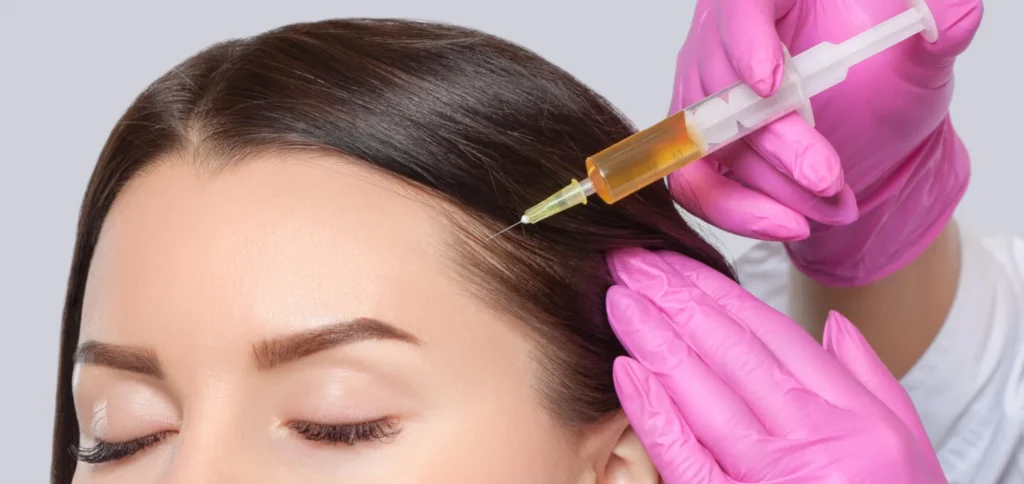 Best PRP Hair Treatment in Dubai