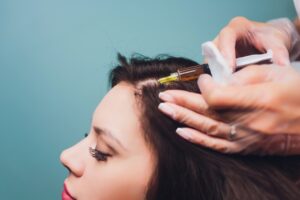 Best PRP Hair Treatment in Dubai