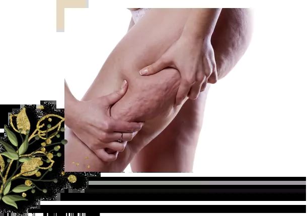 causes of cellulite formation